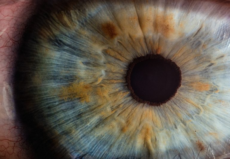 macro photography of human eye